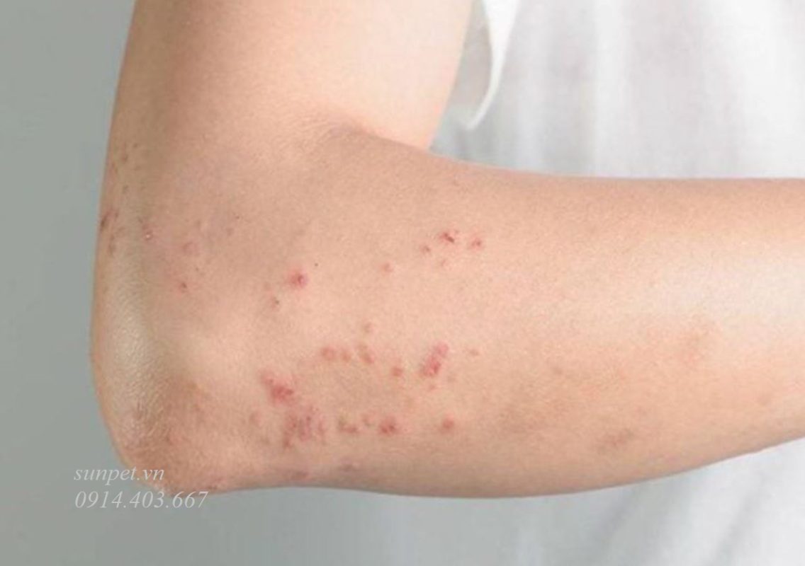 Trứng sán mèo và nguy cơ lây nhiễm cho người Trứng sán mèo và nguy cơ lây nhiễm cho người