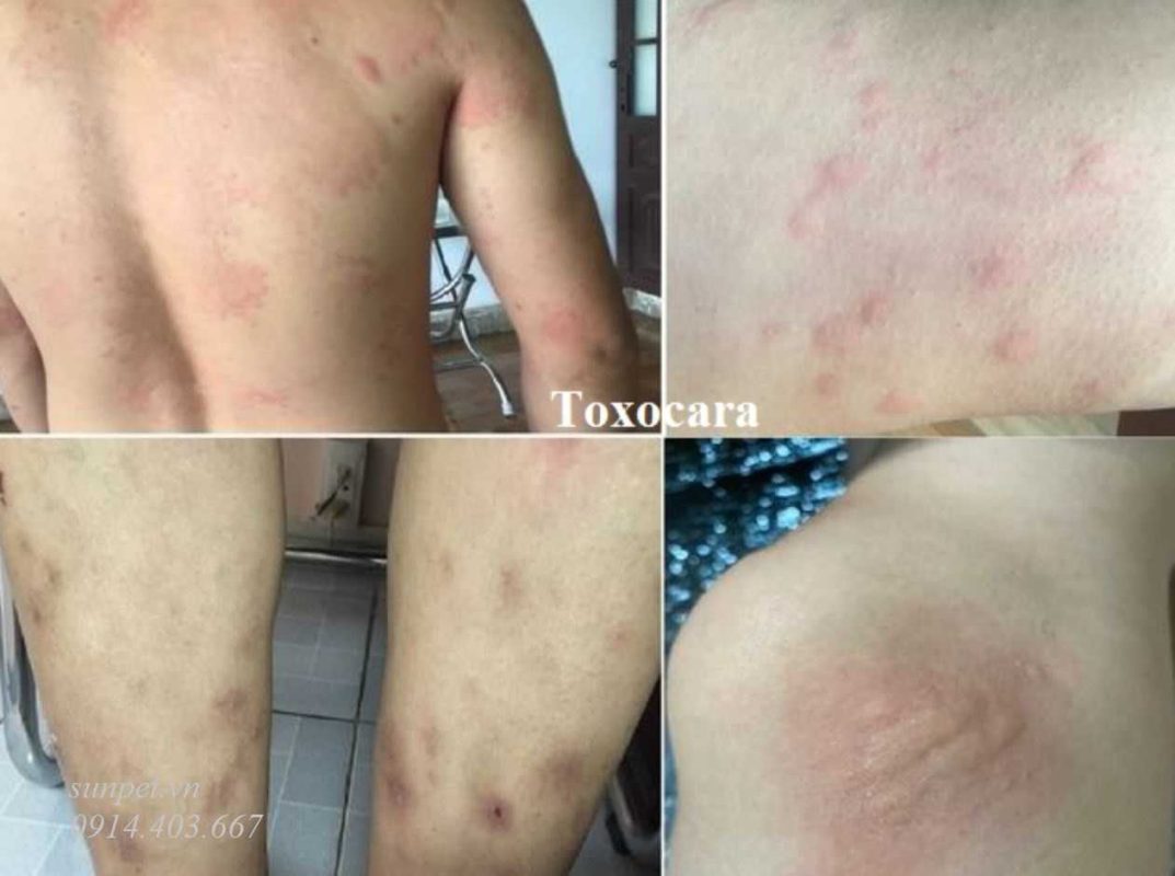 Trứng sán mèo và nguy cơ lây nhiễm cho người Trứng sán mèo và nguy cơ lây nhiễm cho người
